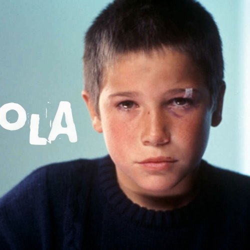 Niño con la cara lastimada mirando a cámara con un fondo azul