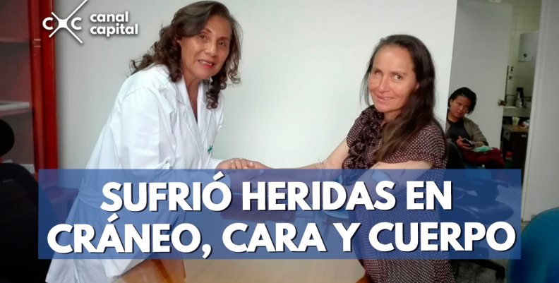 mujer agredida por perros mujer agredida por perros
