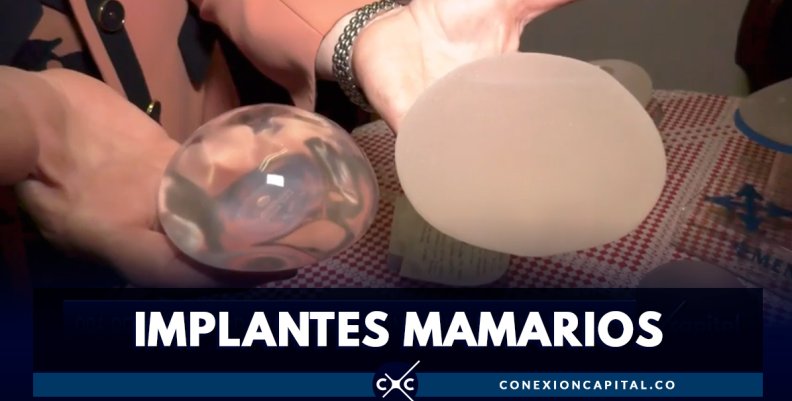 En Colombia, hay más de 900 reportes por problemas relacionados con implantes mamarios En Colombia, hay más de 900 reportes por problemas relacionados con implantes mamarios