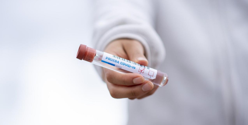 Prueba coronavirus Prueba coronavirus