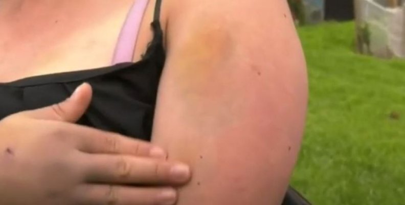 Mujer agredida-feminicidio Mujer agredida-feminicidio