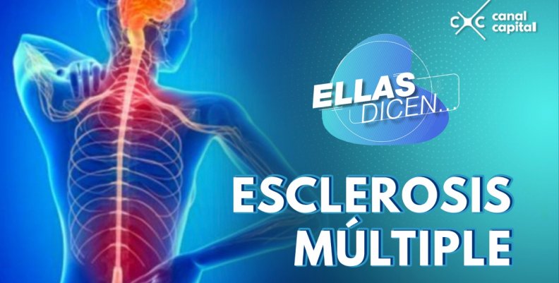 esclerosis-multiple esclerosis-multiple